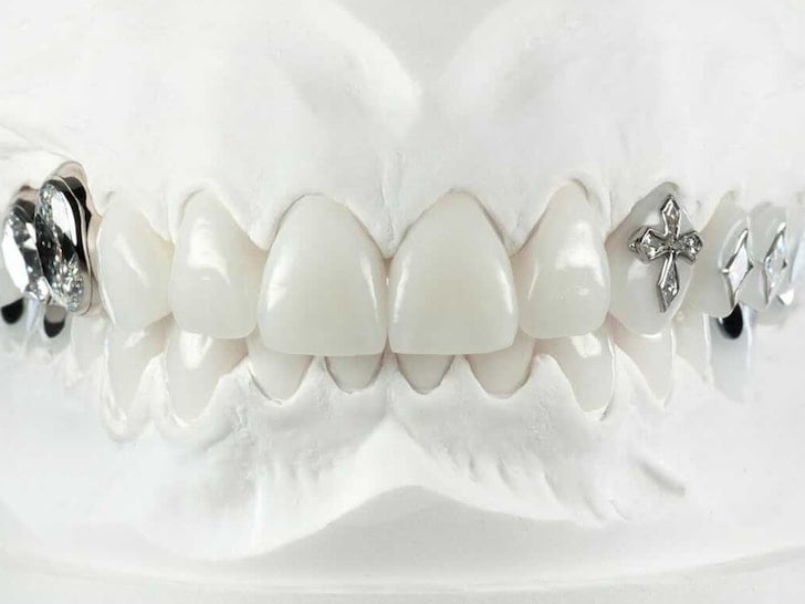 Faccette dentali da 1,8 milioni di dollari