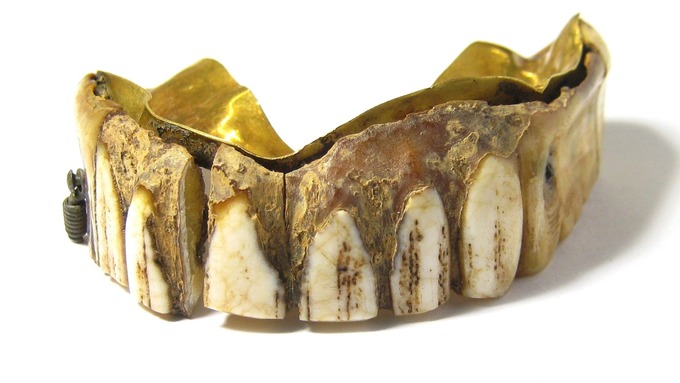 Protesi dentaria in oro e denti d'ippopotamo